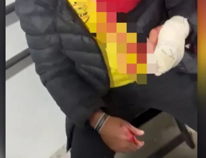 Vereador de MG é acusado de agredir homem com garrafadas em boate