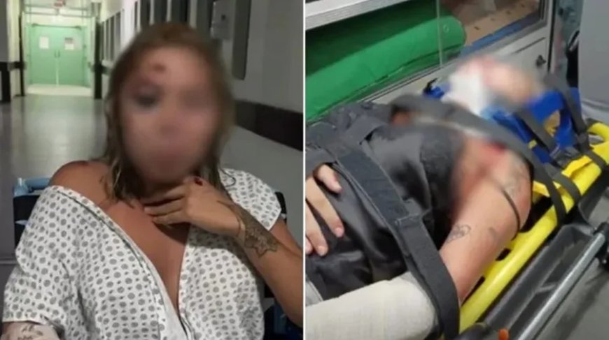 Passageira diz ter sido atropelada por motorista de app após discussão