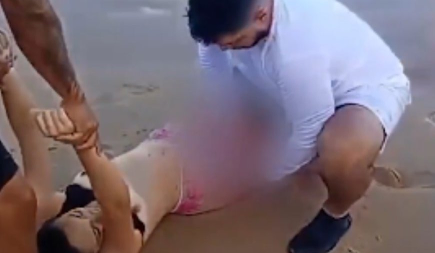 IMAGENS FORTES! Jovem perde a perna após ataque de tubarão em Boa Viagem, um dia após incidente com criança