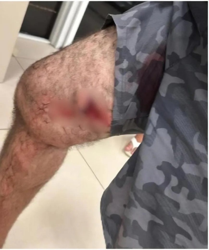Policial militar é preso após balear homem durante discussão