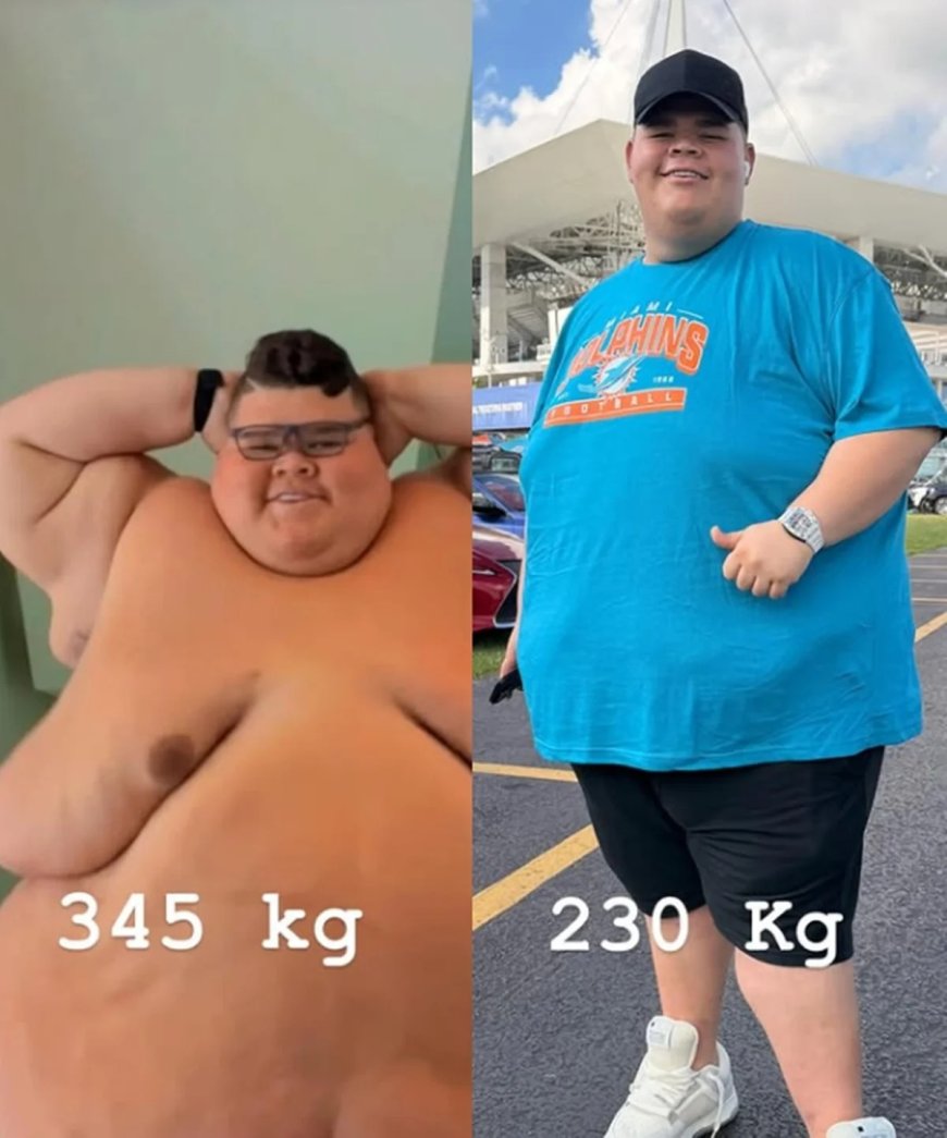 “Progredindo”, afirma Gordão da XJ ao mostrar corpo após perder 130 kg.
