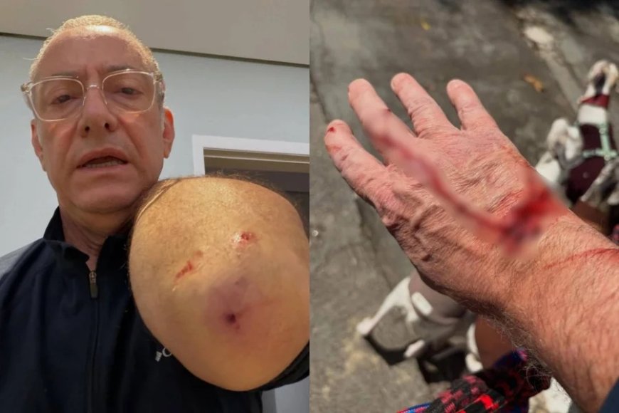 Apresentador da Globo é atacado por pitbull e mostra ferimentos