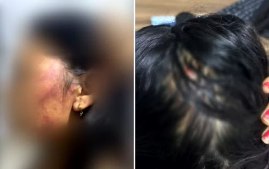 Mulher pula de moto em movimento para se salvar após ser estupr@da e espancada, diz polícia
