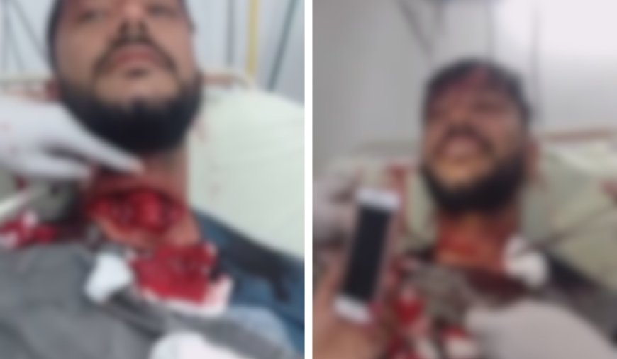 Motociclista sobrevive a corte profundo de cerol e choca a internet ao sorrir durante a cirurgia