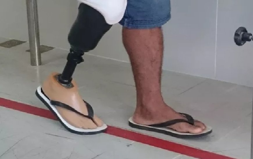 Homem é preso após amputar o pé para receber seguro de R$ 1,5 milhão