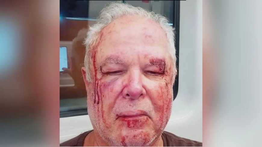 Idoso de 69 anos é atacado por grupo na porta de casa
