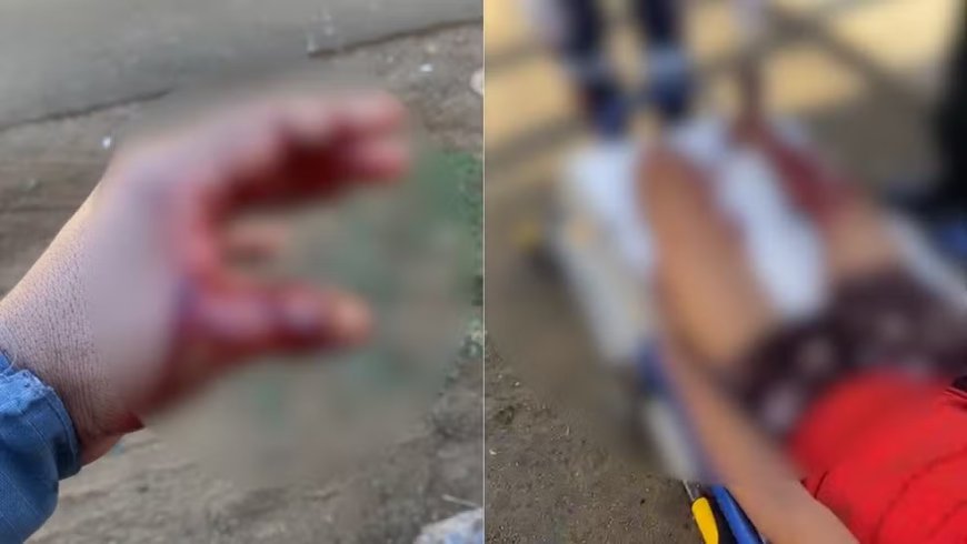 Suspeito fere PM com facada durante abordagem e cena termina em tiros; veja