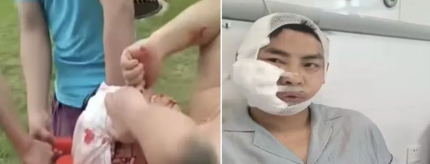 Turista entra em tanque para nadar e acaba atacado por tubarão