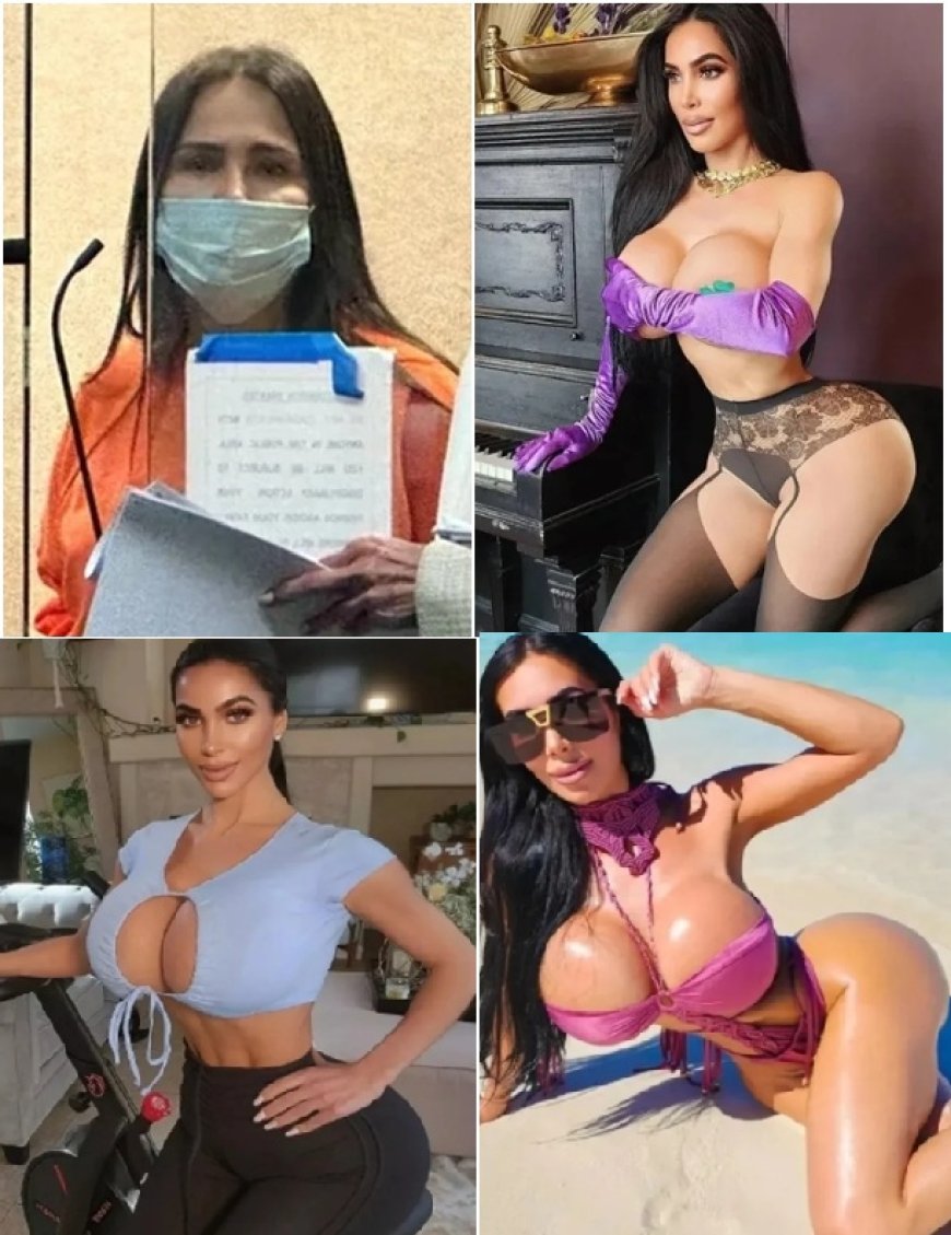 Modelo do OnlyFans morreu após aplicação de silicone; brasileira pega 4 anos de prisão