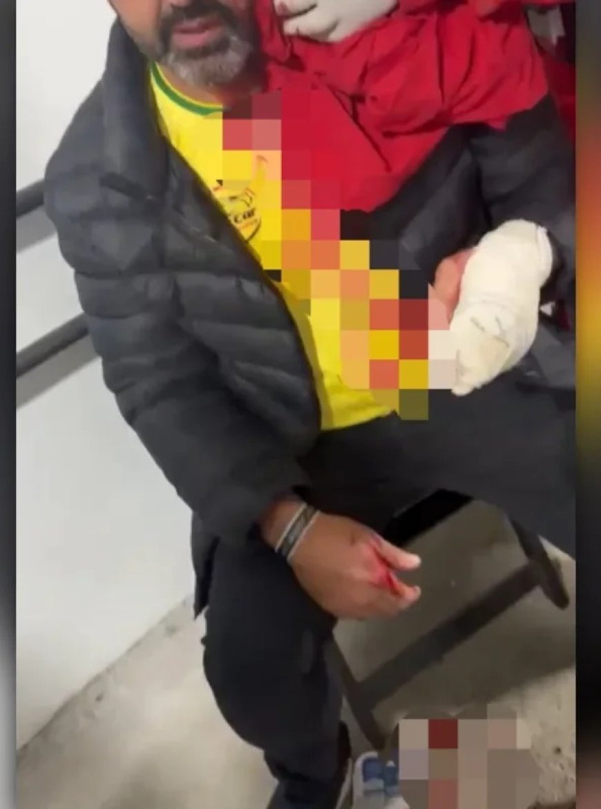 Vereador de MG é acusado de agredir homem com garrafadas em boate