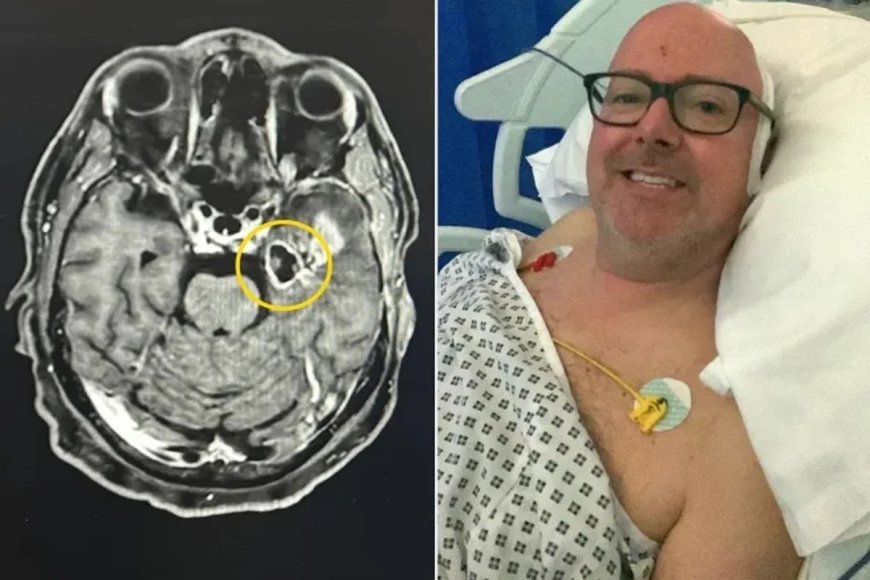 Homem confunde sintomas com efeito de parar de beber e descobre tumor cerebral agressivo