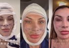 Andressa Urach exibe resultado de 50ª cirurgia plástica e diz ter "rejuvenescido 15 anos"