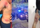 Moradores denunciam ação da Guarda Municipal com bombas e tiros durante jogo do Brasil
