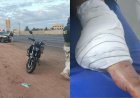 Motociclista atingida por carro na BR-262 perde o pé; família busca motorista fugitivo