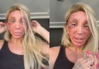 Maya Massafera surge com o rosto irreconhecível após procedimento estético e assusta seguidores