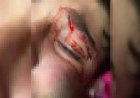 "Achou que ia morrer", diz mãe de adolescente espancado por PM em oficina