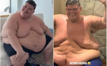De cueca, Gordão da XJ exibe transformação após perder 130 kg; veja antes e depois