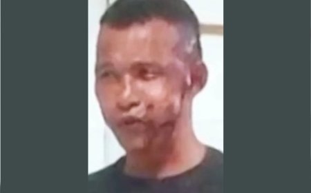 Homem fica de tocaia na porta de delegacia e joga soda cáustica na ex-mulher logo após ela denunciá-lo