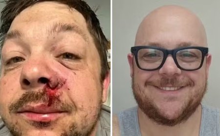 O homem mais azarado? Sobrevive a raio um ano depois de quase morrer com rojão