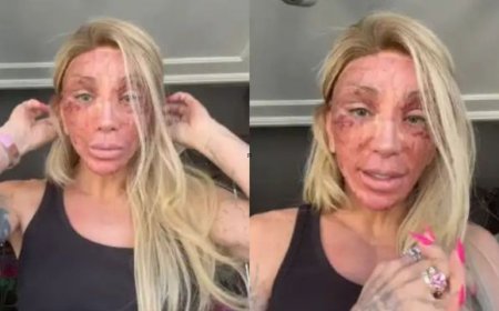 Maya Massafera surge com o rosto irreconhecível após procedimento estético e assusta seguidores
