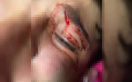"Achou que ia morrer", diz mãe de adolescente espancado por PM em oficina