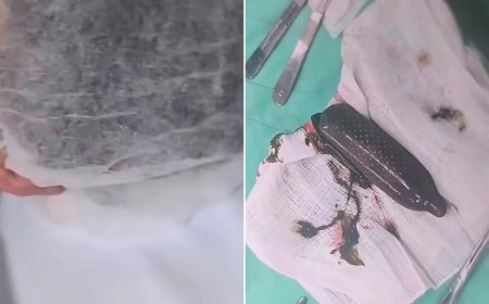 Homem engole camisinha cheia de droga, vai parar no hospital e diz à polícia que era "doce de leite"