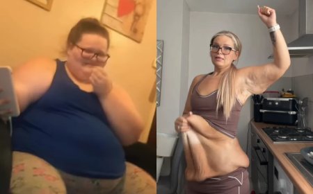 O antes e depois dessa mulher que perdeu 152 kg está emocionando milhares de pessoas