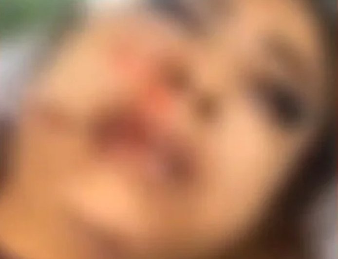 Garota de programa é espancada por cliente após discussão sobre pagamento em MT