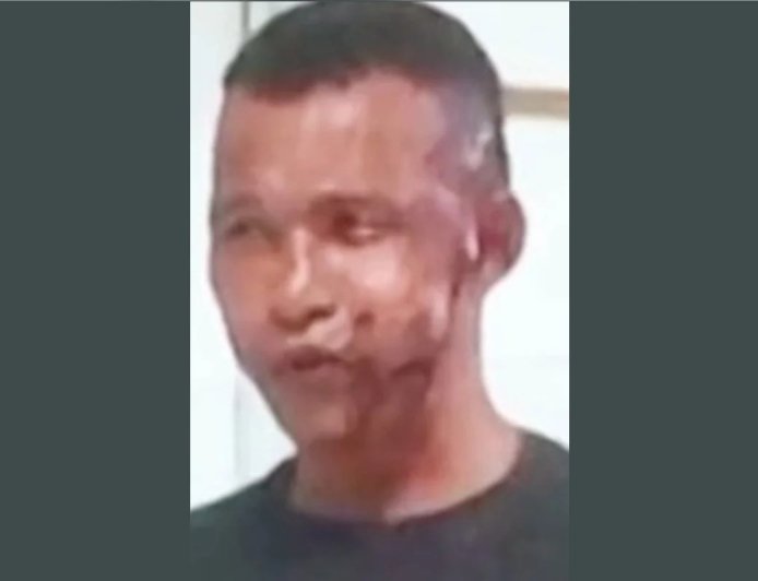 Homem fica de tocaia na porta de delegacia e joga soda cáustica na ex-mulher logo após ela denunciá-lo