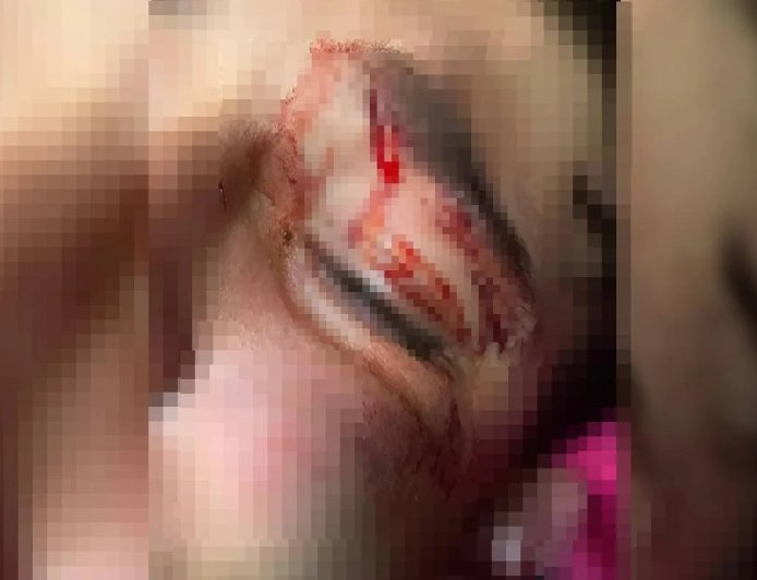 "Achou que ia morrer", diz mãe de adolescente espancado por PM em oficina