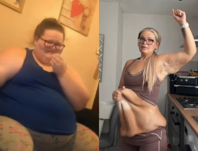O antes e depois dessa mulher que perdeu 152 kg está emocionando milhares de pessoas