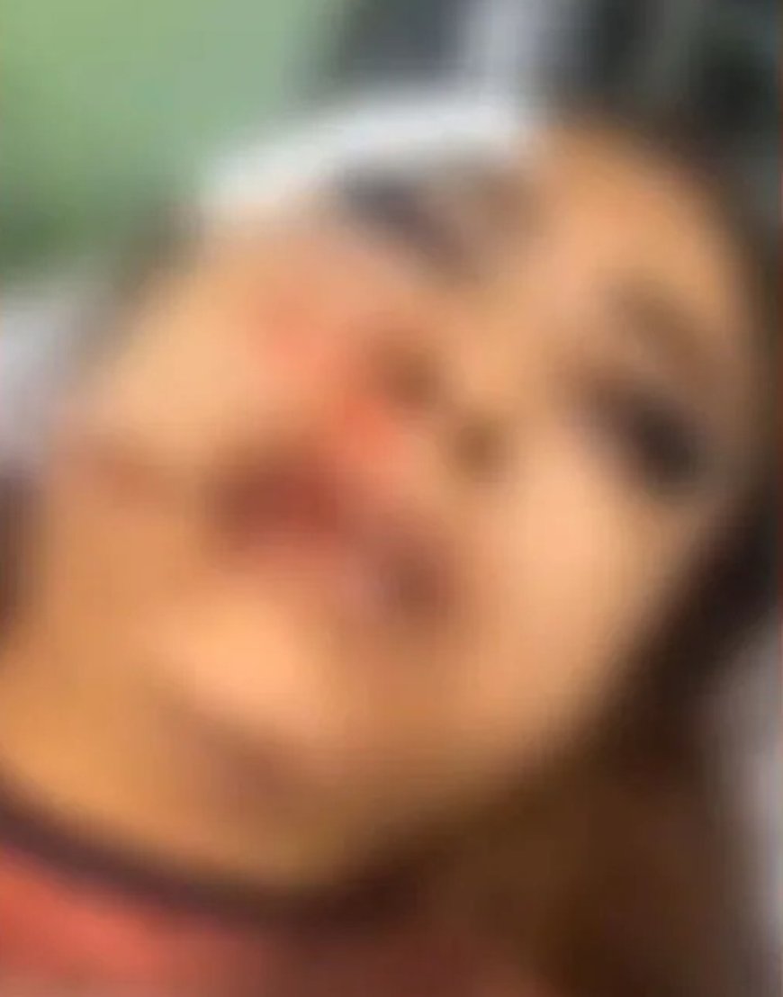 Garota de programa é espancada por cliente após discussão sobre pagamento em MT