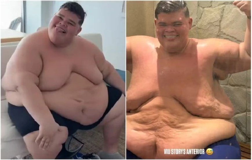 De cueca, Gordão da XJ exibe transformação após perder 130 kg; veja antes e depois