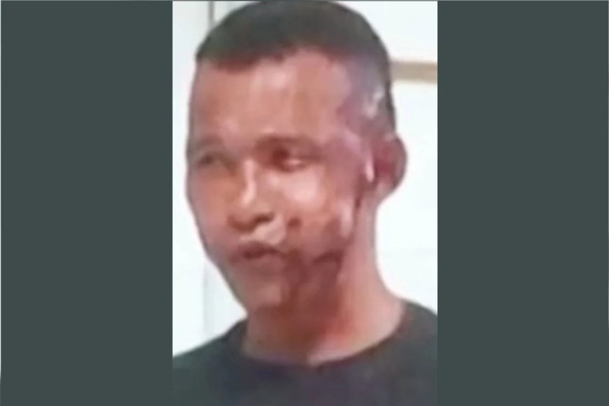Homem fica de tocaia na porta de delegacia e joga soda cáustica na ex-mulher logo após ela denunciá-lo