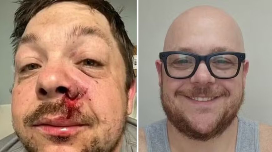 O homem mais azarado? Sobrevive a raio um ano depois de quase morrer com rojão
