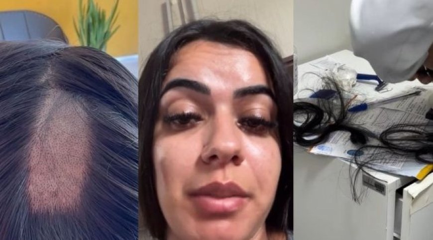 Foi renovar a CNH e saiu com um buraco no couro cabeludo; veja o desabafo