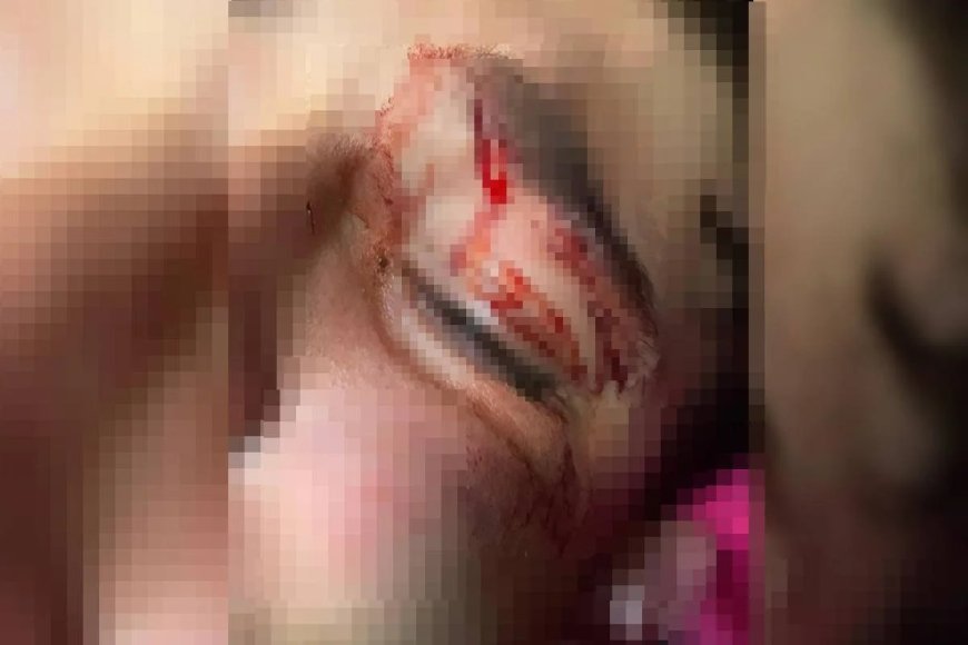 "Achou que ia morrer", diz mãe de adolescente espancado por PM em oficina